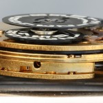 Side view of ESA 9159 complications.
